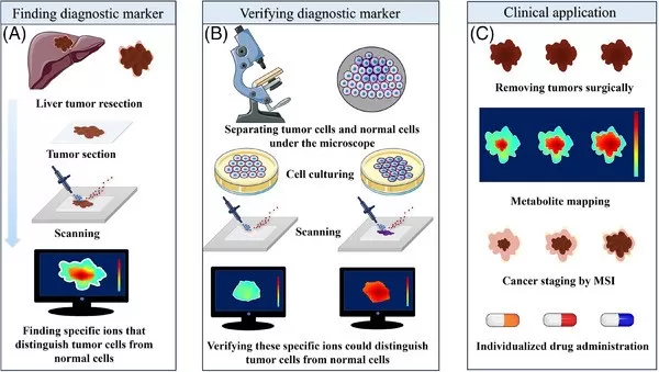 Utilizing Spatial Metabolomics for Real-Time Surgical Guidance and Tumor Diagnosis. Utilizing Spatial Metabolomics for Real-Time Surgical Guidance and Tumor Diagnosis.